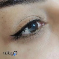 میکروبلیدینگ و میکروپیگمنتیشن