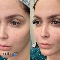 کلینیک زیبایی بنیتا تهرانپارس