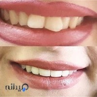 فلوشیپ دندانپزشکی زیبایی و ایمپلنت دیجیتال