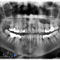 موسسه تخصصی رادیولوژی دهان ، فک و صورت دکتر مرجان بابادی بروجنی