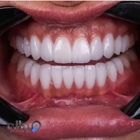 دندانپزشکی دنت پلاس