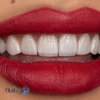 دندانپزشکی دکتر نازنین شیخی