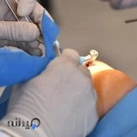 دکتر مهدی ابریشمی | متخصص جراحی فک و صورت و تروما در اصفهان
