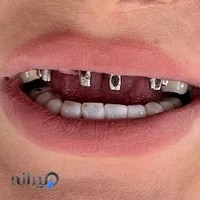 مرکز دندانپزشکی دکتر حامد کریمی پور ایمانی