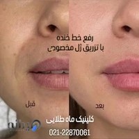 کلینیک زیبایی ماه طلایی