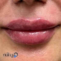 کلینیک تخصصی پوست و زیبایی بهشاد💉👩🏻‍🦰