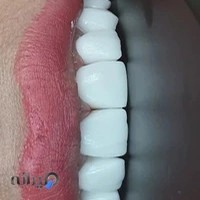 کلینیک دندانپزشکی برف