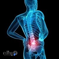 بهبود دیسک کمر بدون جراحی دکتر خالکباف