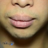 دکتر آزاده قائمی، متخصص دندانپزشکی ترمیمی و زیبایی