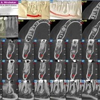 Dental Radiology