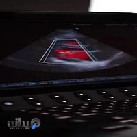 رادیولوژی سونوگرافی زیتون