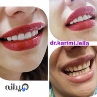 دکتر لیلا کریمی