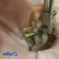مطب دندانپزشکی دکتر مرتضی کریمی عبدالملکی و دکتر فرزانه خیرخواه