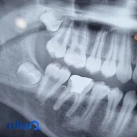 کلینیک دندانپزشکی شبانه روزی