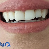 دکتر علی عزیزی | دندانپزشک مشهد