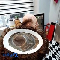 پروتز موی طبیعی پاسداران