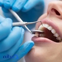 Mary Dent مطلب دندانپزشکی دکتر مریم فتحی