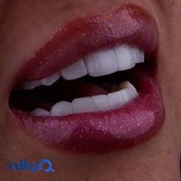 دندانپزشکی دکتر آزاده قاسمی