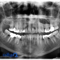 موسسه تخصصی رادیولوژی دهان ، فک و صورت دکتر مرجان بابادی بروجنی