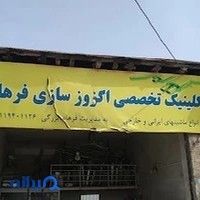اگزوزسازی فرهاد