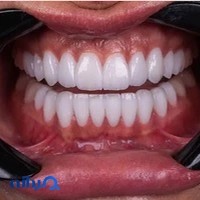 دندانپزشکی دنت پلاس