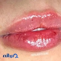 کلینیک زیبایی ویتا