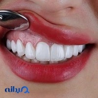 دندانپزشکی نفس دنتال