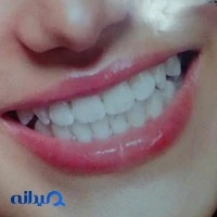 دندانسازی نصراللهی