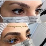 مرکز میکروبلیدینگ مقدم