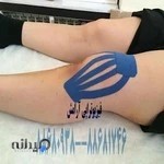 کلینیک فیزیوتراپی آرامش