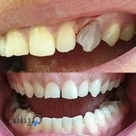 دکتر فرزین مازیار متخصص درمان ریشه