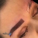 کلینیک فوق تخصصی کاشت مو و ابرو
