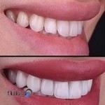 دکتر فروغ فدوی