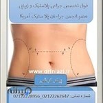 دکتر فیض الله نیازی شهرکی، فوق تخصص جراحی پلاستیک