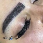 کلینیک زیبایی نیایش