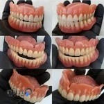 لابراتوار دندان ظفر