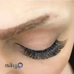 اکستنشن لیزری موی سحر صابر