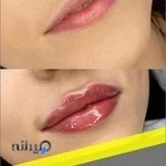 کلینیک زیبایی سابرینا