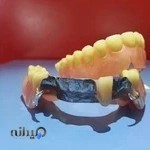 دندانسازی عادل حقی