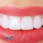 دندانپزشکی پاستور زنجان