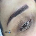 ميكروبليدينگ آرين