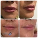 مطب زیبایی دکتر پرستو برهانی