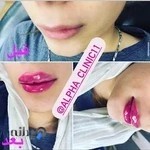 کلینیک پوست و مو آلفا