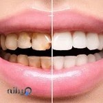 دندانپزشکی مروارید پاکدشت