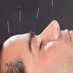 دکتر فرخنده رهنما متخصص لیزر و طب سوزنی