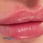 مطب زیبایی دکتر شهرزاد فولادی