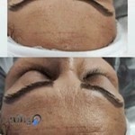 زیبایی و مراقبت پوست دیاموند