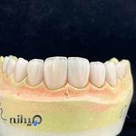 لابراتوار دندانسازی فوق تخصصی زیبایی شریعتی