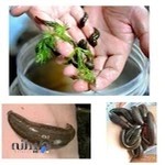 زالو درمانی خیابان فرشته