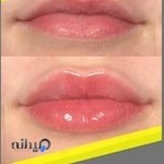 مطب پوست مو زیبایی سابرینا